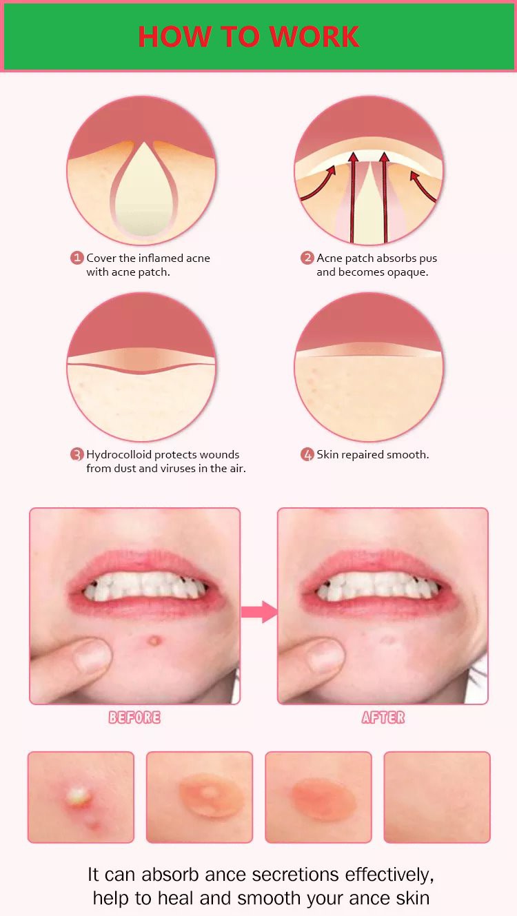 tea tree oil patch 3 tea tree oil patch 3
