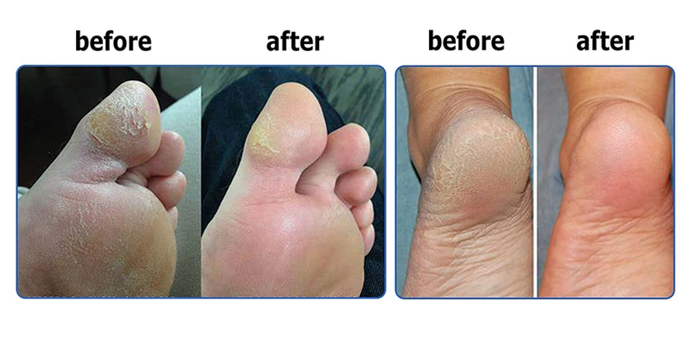 silicone heel socks silicone heel socks