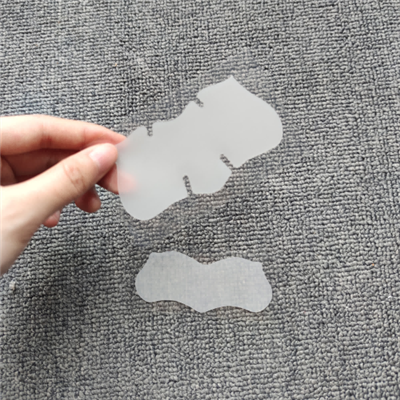 Odstránenie čiernych bodiek pásikmi z nosa